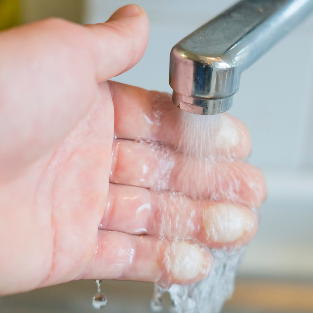 brulure premier degré. Image illustrative