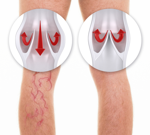 JAMBES LOURDES. IMAGE DECORATIVE